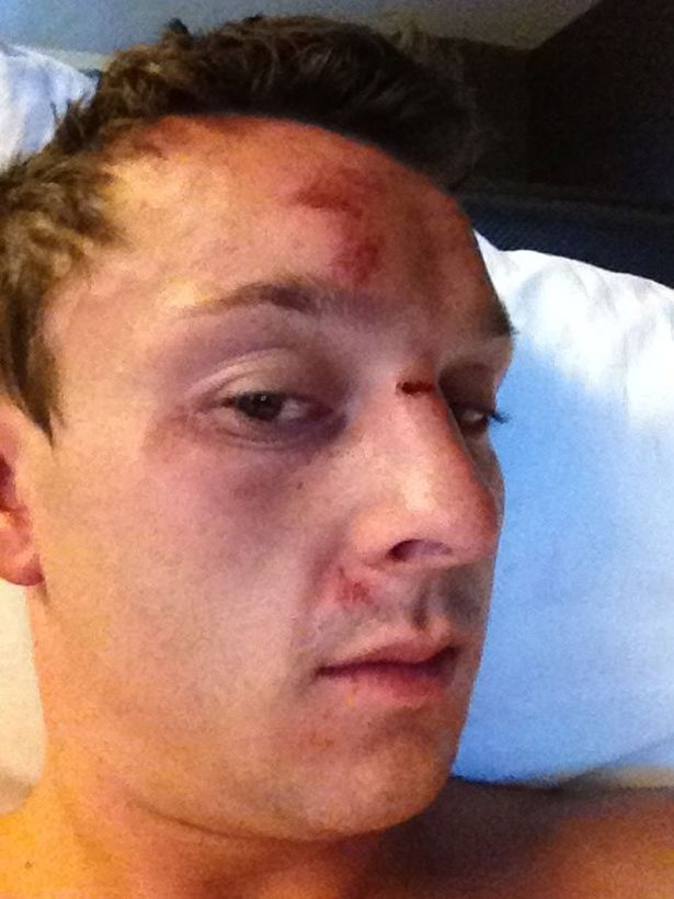 Sam Trickett known as Tricky, was beaten up by six guys after coming second in a poker tournament in Las Vegas.jpg